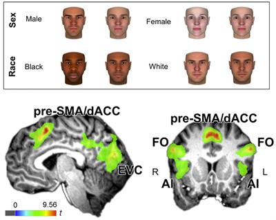 Reflections on Neurofeminism and Intersectionality Using Insights From Psychology